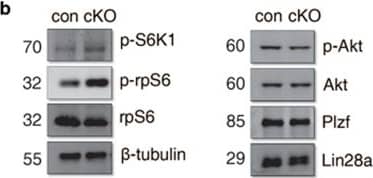 Detection of Mouse PLZF by Western Blot