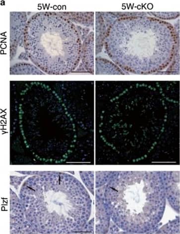 Detection of Mouse PLZF by Western Blot