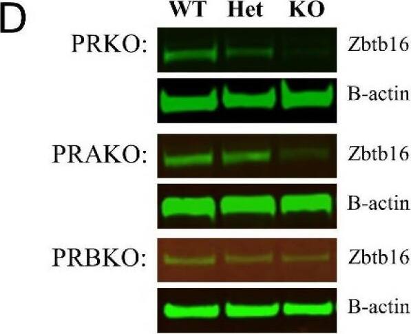 Detection of PLZF by Western Blot