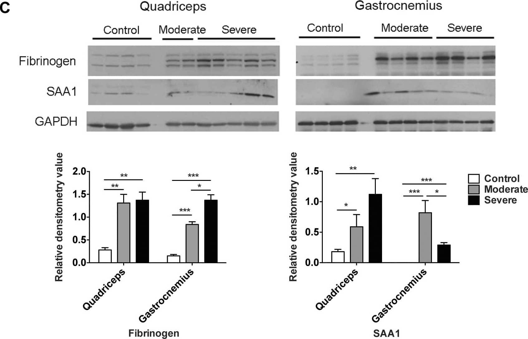 Detection of Serum Amyloid A1/A2 by Western Blot