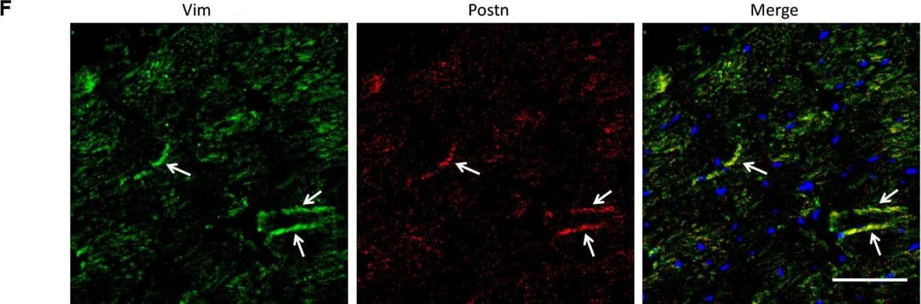 Detection of Mouse Periostin/OSF-2 Isoform 2 by Immunohistochemistry