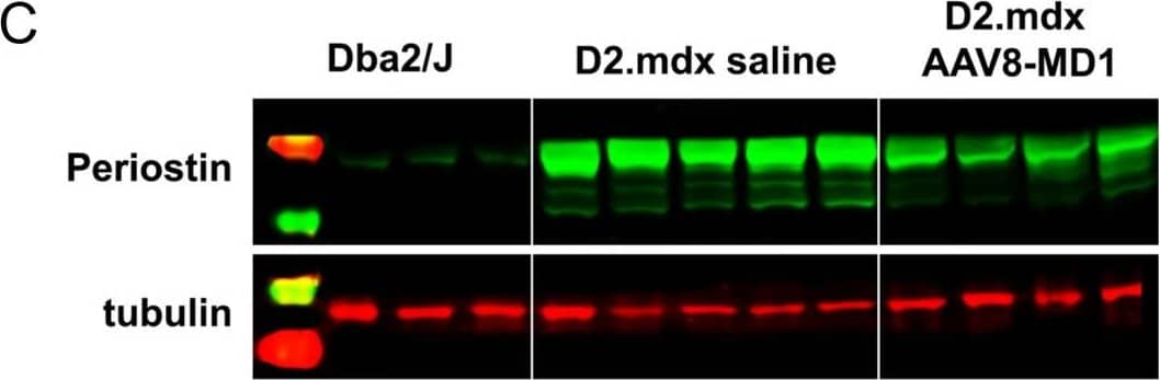 Detection of Periostin/OSF-2 Isoform 2 by Western Blot