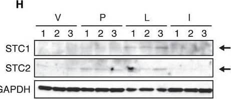 Detection of Stanniocalcin 1/STC-1 by Western Blot