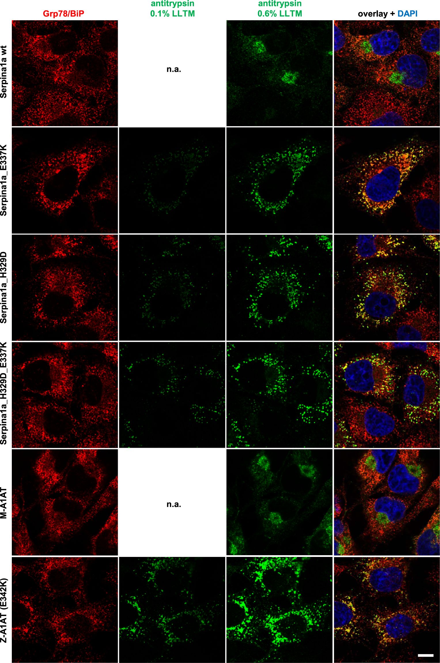Detection of Monkey Serpin A1c/alpha 1-Antitrypsin by Immunocytochemistry/Immunofluorescence