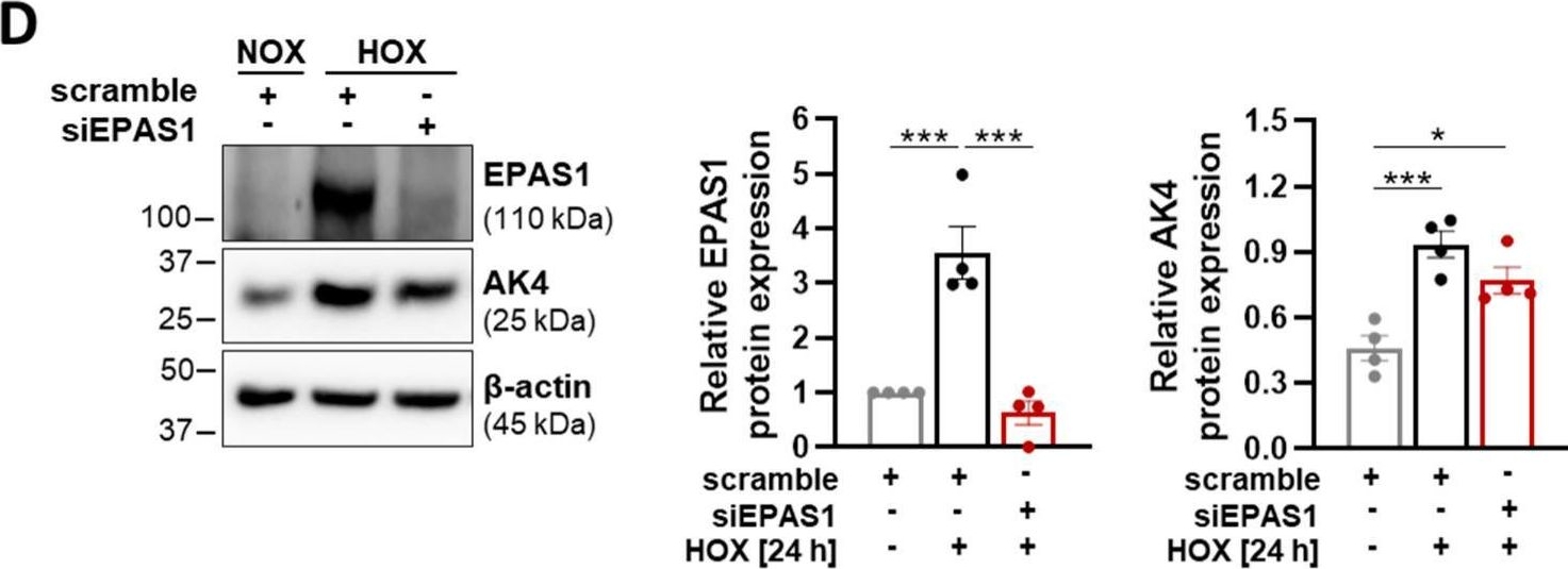 Detection of HIF-2 alpha /EPAS1 by Western Blot