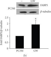Detection of Human BTLA/CD272 by Western Blot