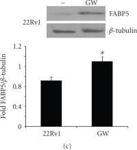 Detection of Human BTLA/CD272 by Western Blot