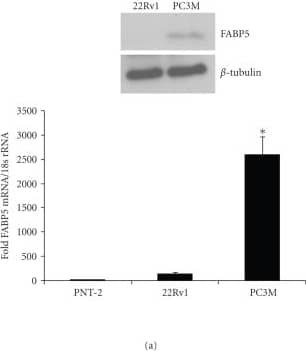 Detection of Human BTLA/CD272 by Western Blot