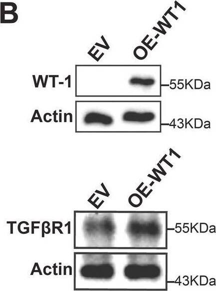 Detection of TGF-beta RI/ALK-5 by Western Blot