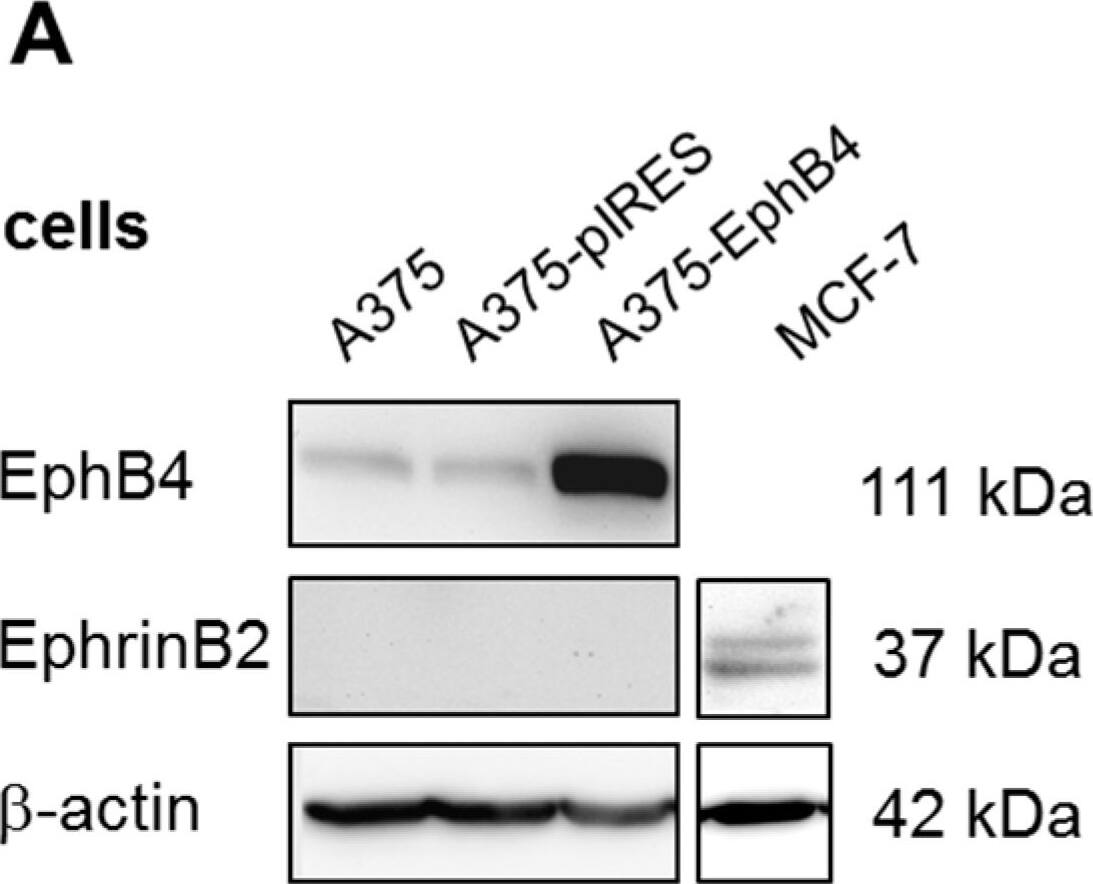 Detection of Mouse EphB4 by Western Blot