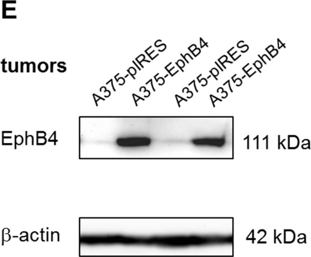 Detection of Mouse EphB4 by Western Blot