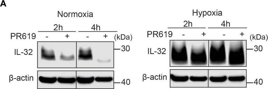 Detection of IL-32 by Western Blot