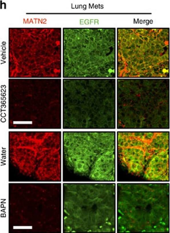 Detection of Mouse Matrilin-2 by Immunohistochemistry
