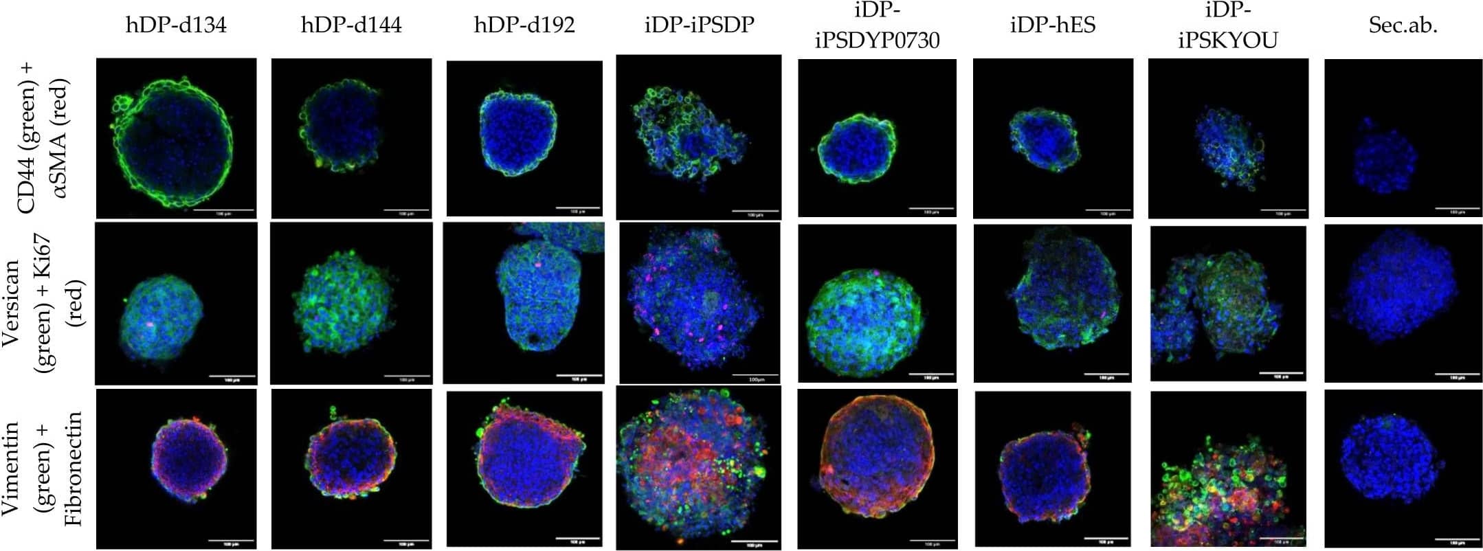 Detection of Human Human Versican Isoform V0 Antibody by Immunocytochemistry/ Immunofluorescence