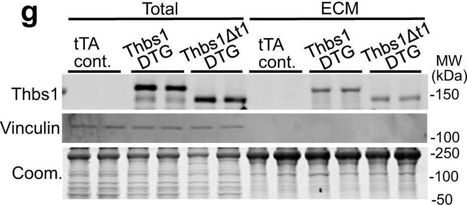 Detection of Mouse Thrombospondin-1 by Western Blot