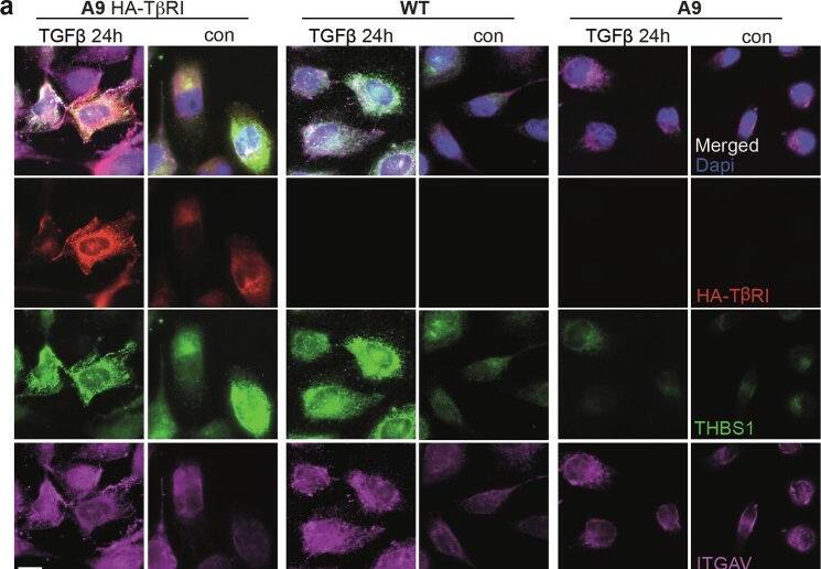 Detection of Thrombospondin-1 by Immunocytochemistry/ Immunofluorescence