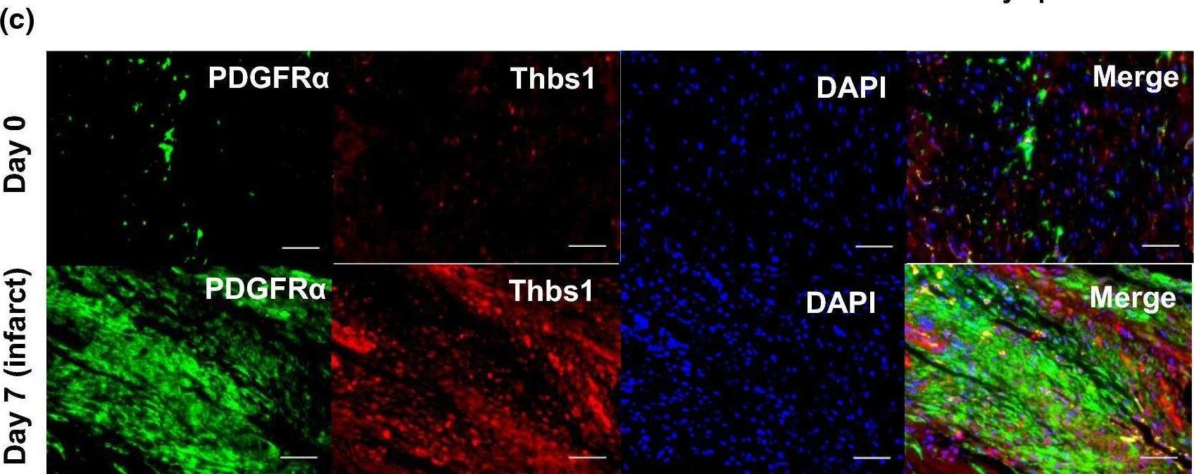 Detection of Thrombospondin-1 by Immunohistochemistry