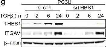 Detection of Thrombospondin-1 by Western Blot