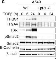 Detection of Thrombospondin-1 by Western Blot