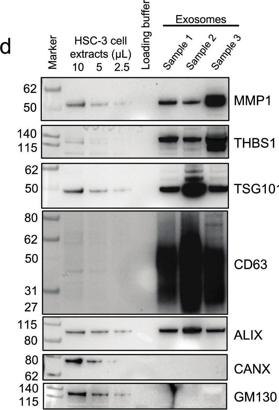 Detection of Thrombospondin-1 by Western Blot