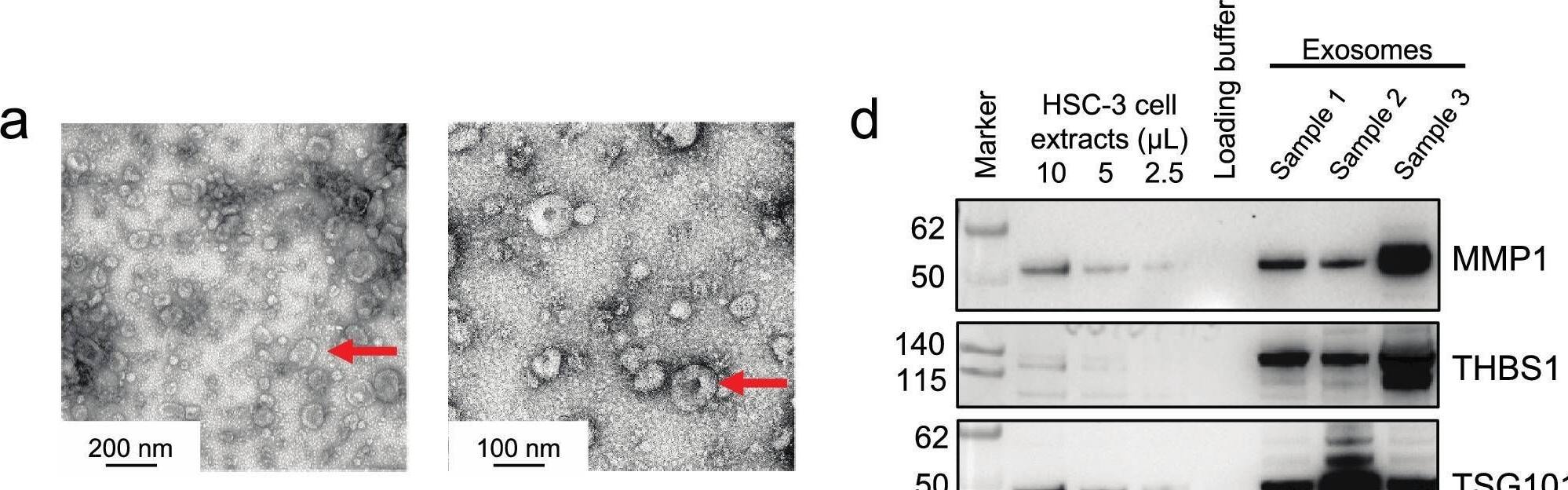 Detection of Thrombospondin-1 by Western Blot