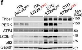 Detection of Thrombospondin-1 by Western Blot