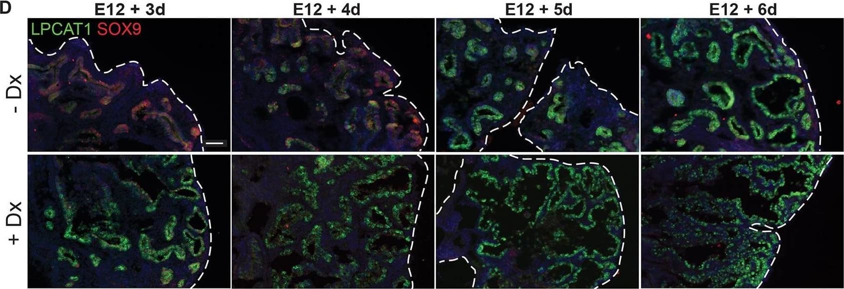 Detection of Mouse Human SOX9 Antibody by Immunohistochemistry