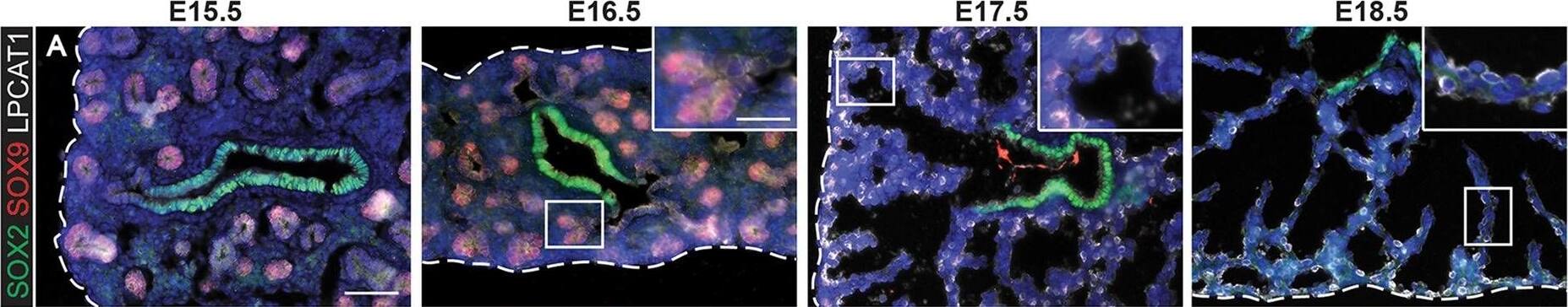 Detection of Mouse Human SOX9 Antibody by Immunohistochemistry