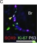 Detection of Human SOX9 by Immunocytochemistry/Immunofluorescence