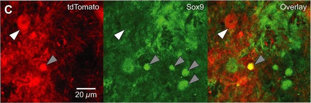 Detection of Mouse SOX9 by Immunocytochemistry/Immunofluorescence