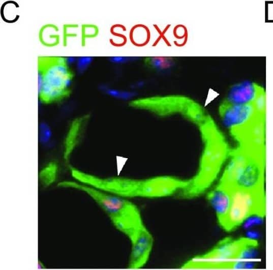 Detection of Human SOX9 by Immunocytochemistry/Immunofluorescence