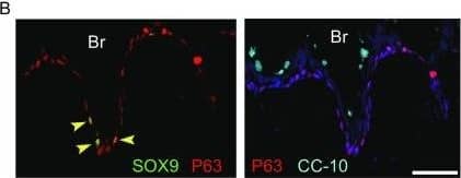 Detection of Human SOX9 by Immunocytochemistry/Immunofluorescence