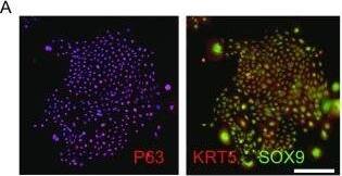 Detection of Human SOX9 by Immunocytochemistry/Immunofluorescence