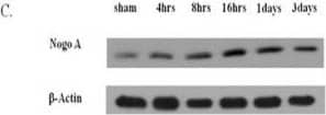 Detection of Rat Nogo-A by Western Blot