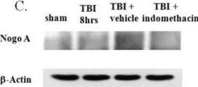 Detection of Rat Nogo-A by Western Blot