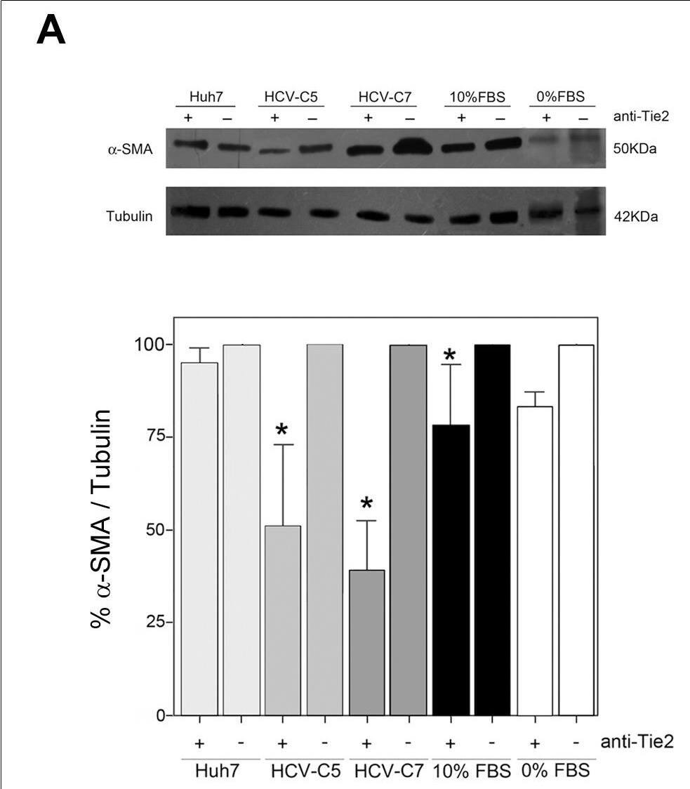 Detection of Human Tie-2 by Western Blot