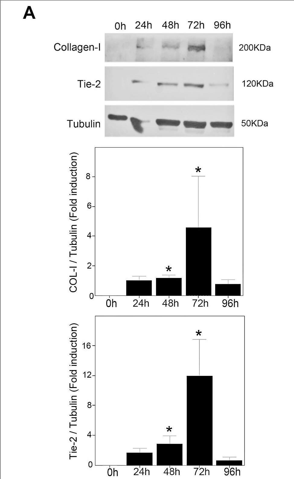 Detection of Human Tie-2 by Western Blot