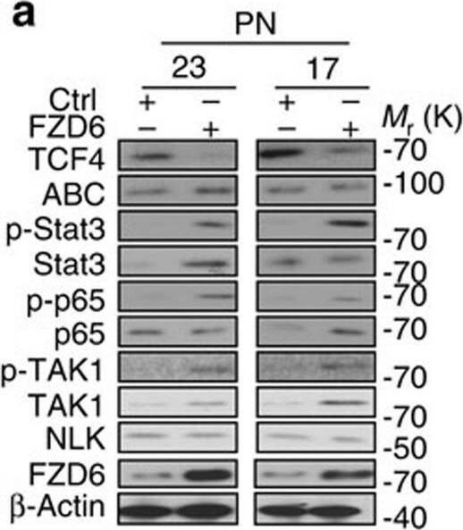 Detection of Frizzled-6 by Western Blot