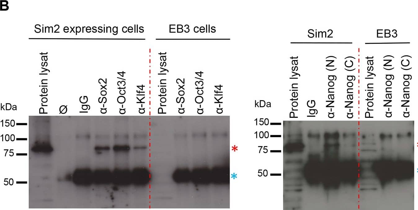 Detection of Mouse KLF4 by Chromatin Immunoprecipitation