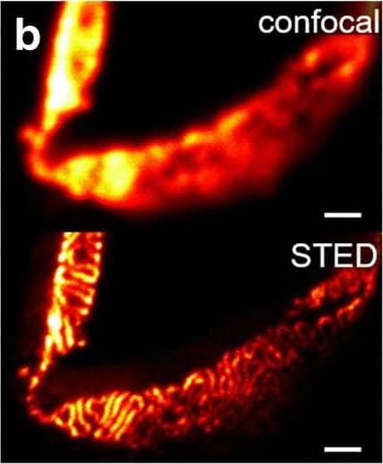 Detection of Mouse Nephrin by Immunocytochemistry/ Immunofluorescence