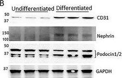 Detection of Mouse Nephrin by Western Blot
