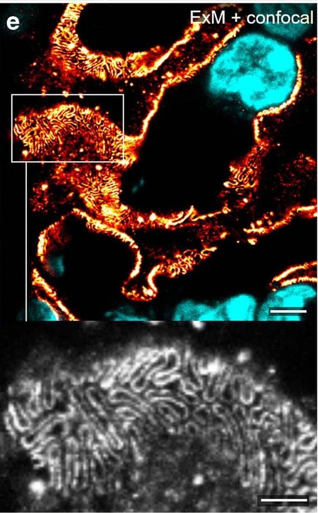 Detection of Mouse Nephrin by Immunocytochemistry/ Immunofluorescence