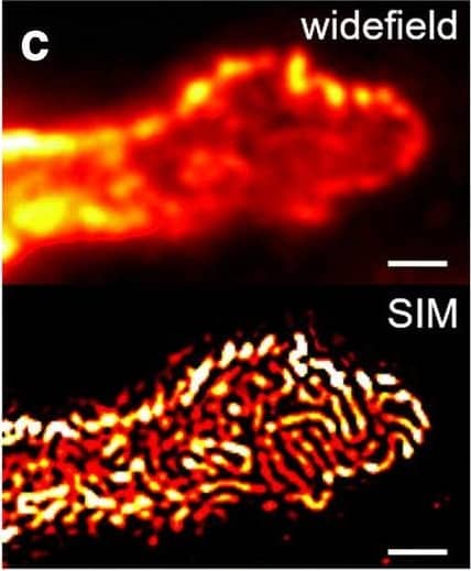 Detection of Mouse Nephrin by Immunocytochemistry/ Immunofluorescence