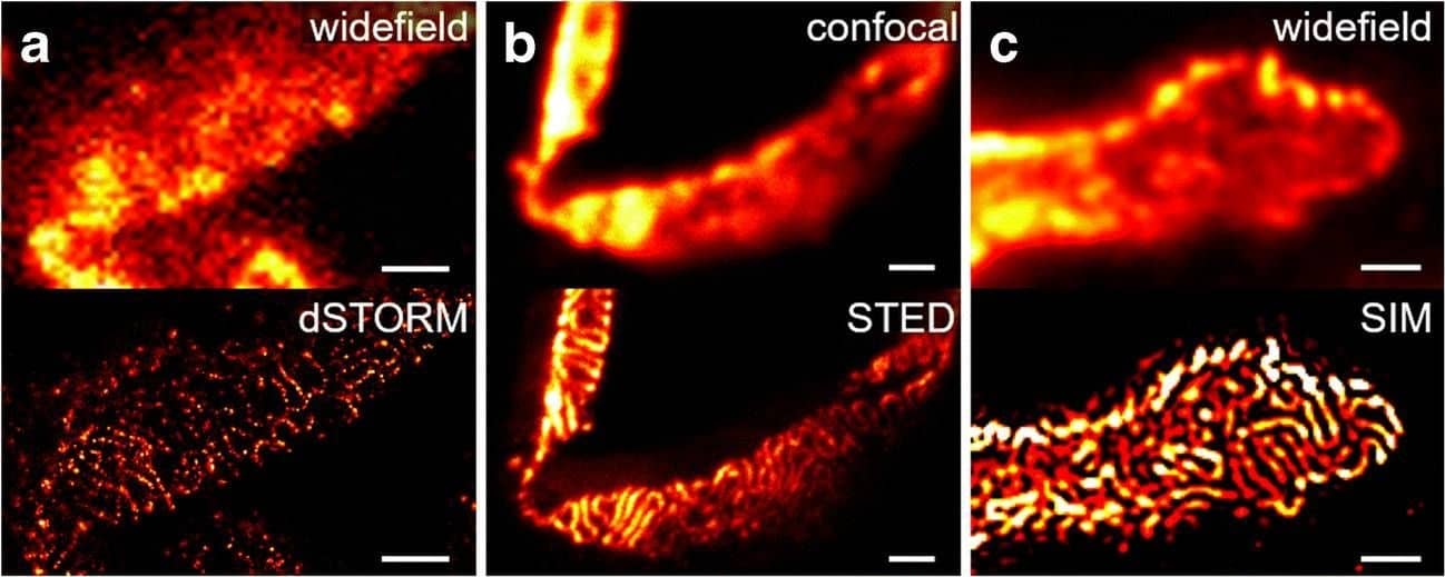 Detection of Mouse Nephrin by Immunocytochemistry/ Immunofluorescence
