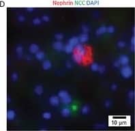 Detection of Mouse Nephrin by Immunocytochemistry/ Immunofluorescence