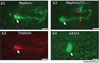 Detection of Mouse Nephrin by Immunocytochemistry/ Immunofluorescence