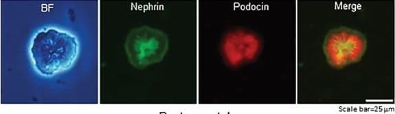 Detection of Mouse Nephrin by Immunocytochemistry/ Immunofluorescence