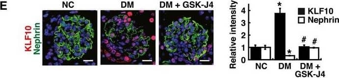 Detection of Mouse Nephrin by Immunocytochemistry/Immunofluorescence