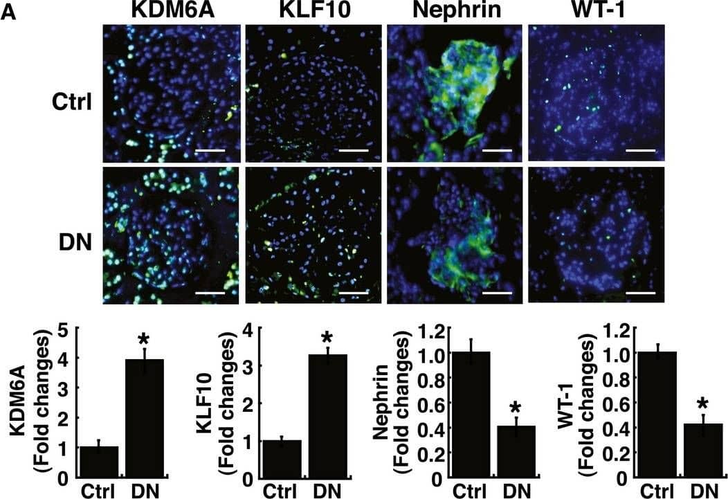 Detection of Mouse Nephrin by Immunocytochemistry/Immunofluorescence