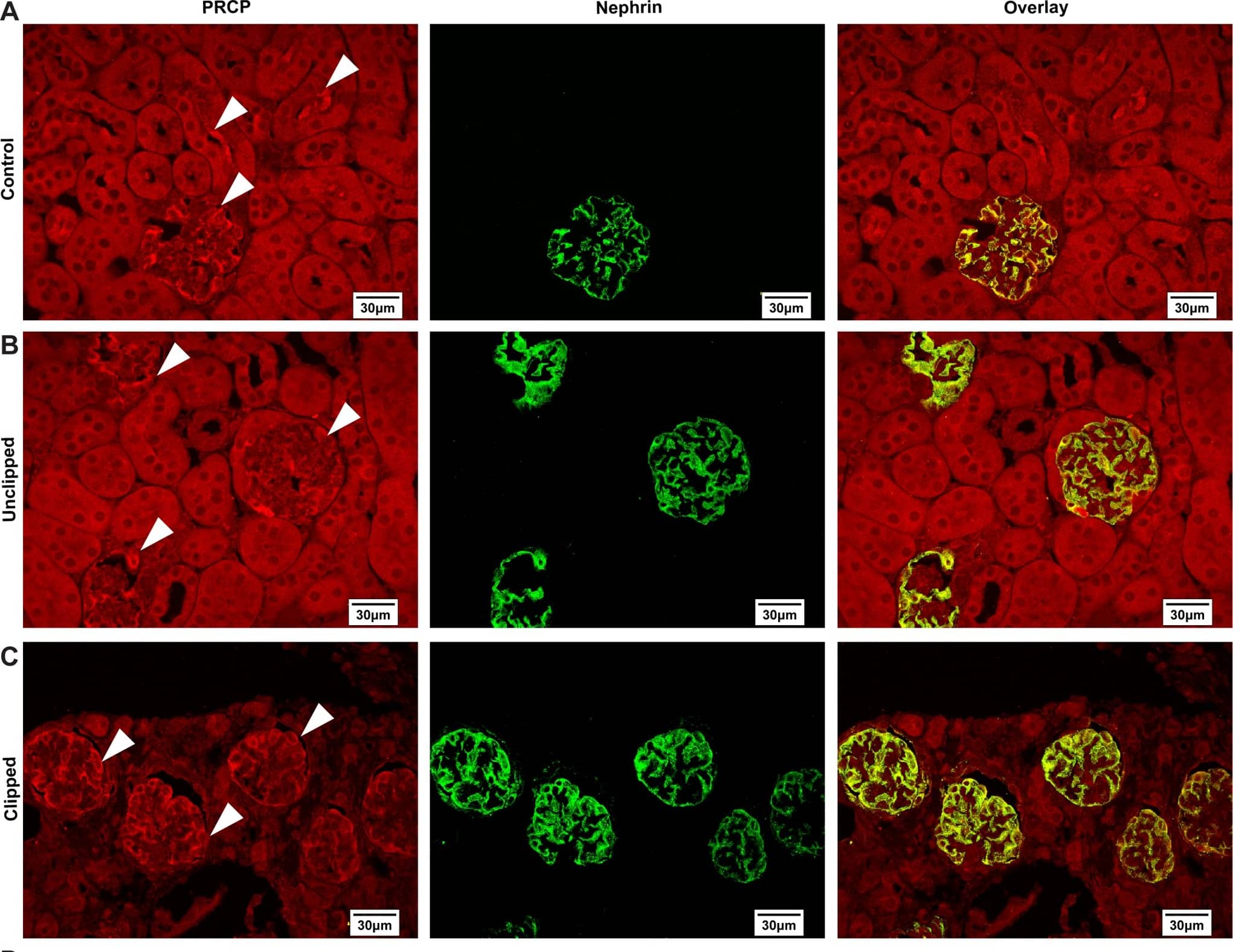 Detection of Mouse Nephrin by Immunocytochemistry/Immunofluorescence